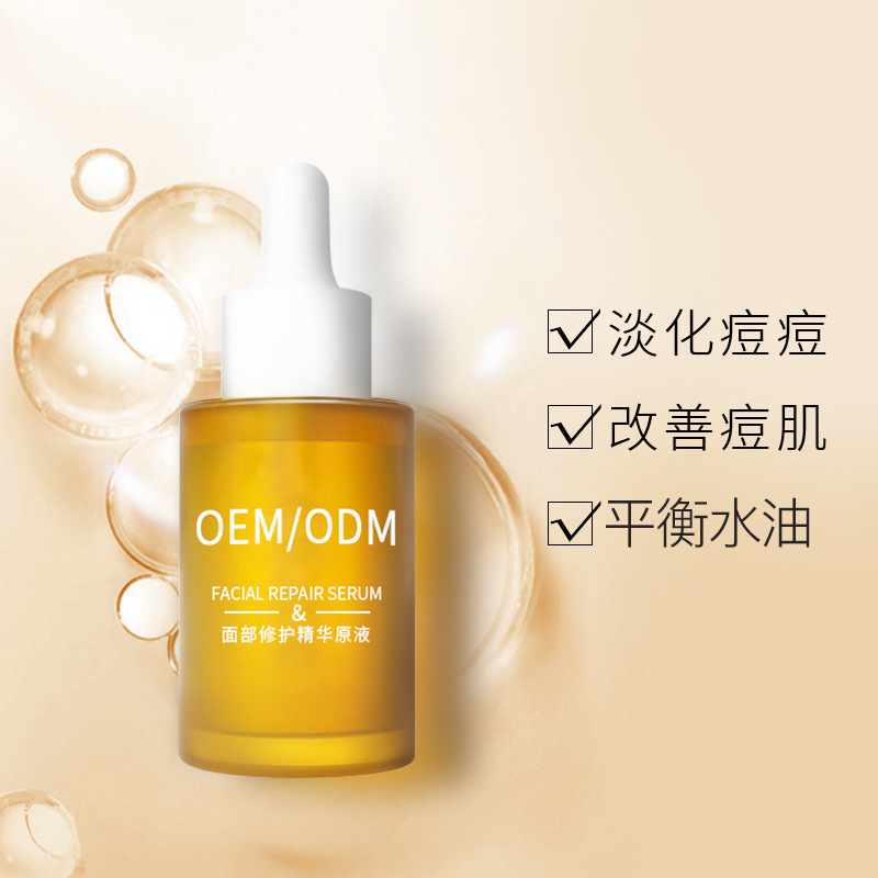 雅安市_祛痘精华原液OEM